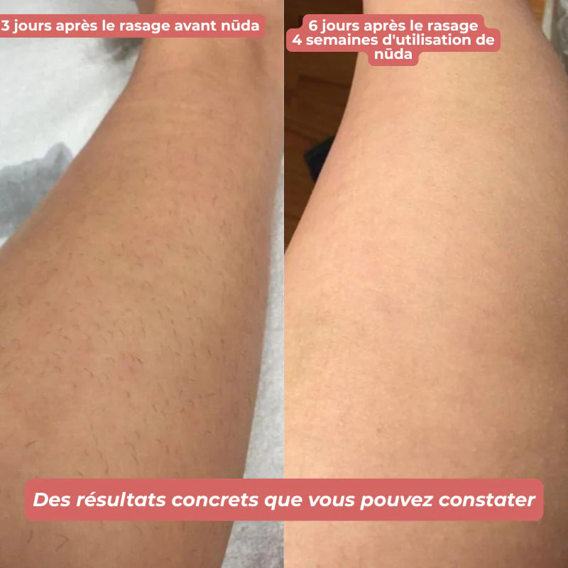 nūda™ Huile de Cyperus Rotundus